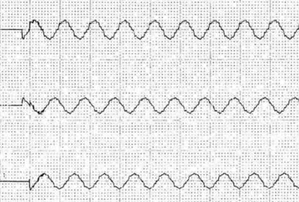 ����a(b��)�����þ��l���_�P(gu��n)Ͷ�Еr(sh��)���ΈD